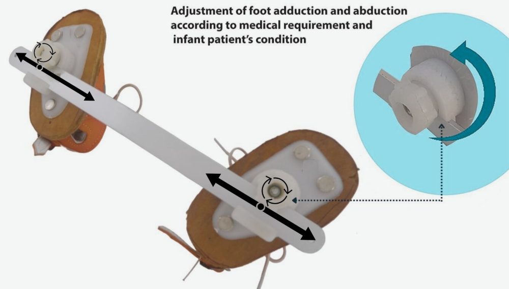 Dennis Brown Splint Shoes For Club Foot - Image 6