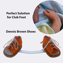 Denis Browne Bar for Clubfoot Correction | Foot Abduction Brace